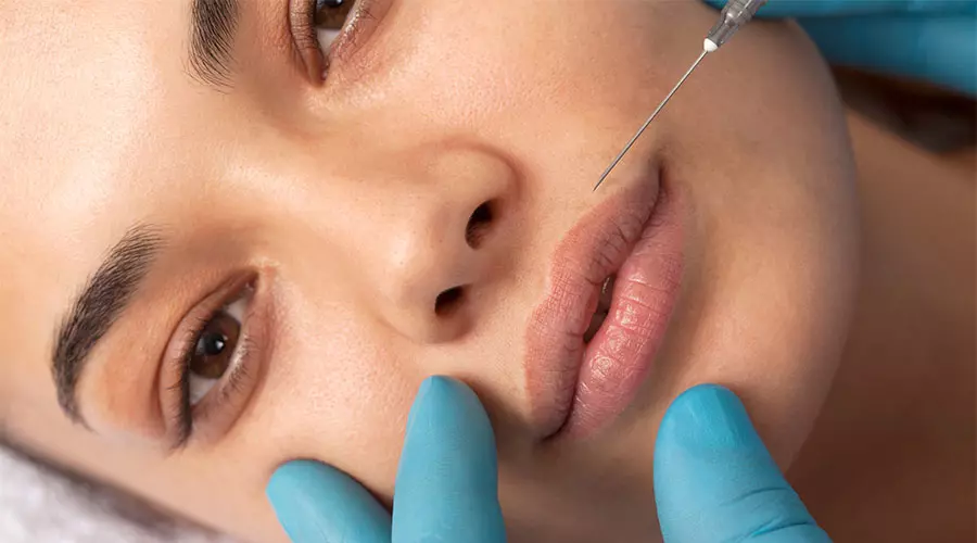 Photo d'application de botox sur les lèvres d'une patiente